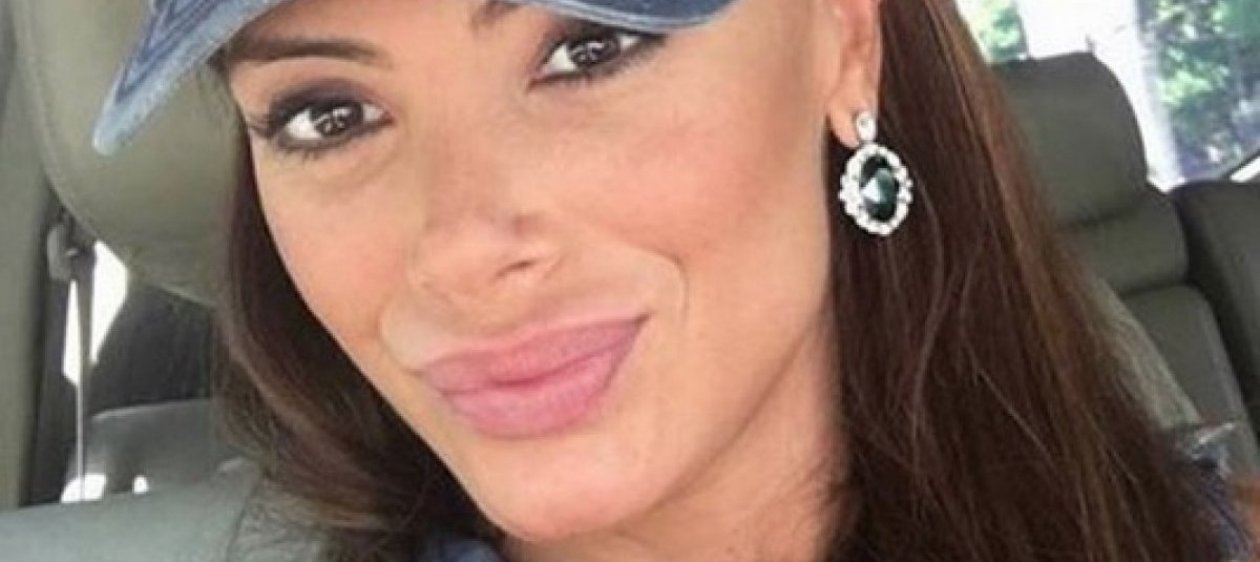 Roxana Muñoz reconstruyó sus labios y así se ve post operación
