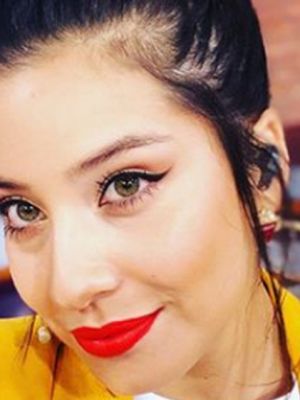 María José Quintanilla reveló detalles de su doloroso accidente: 