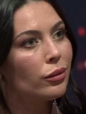 ¡Como Angelina Jolie! Daniela Aránguiz se hizo retoque estético