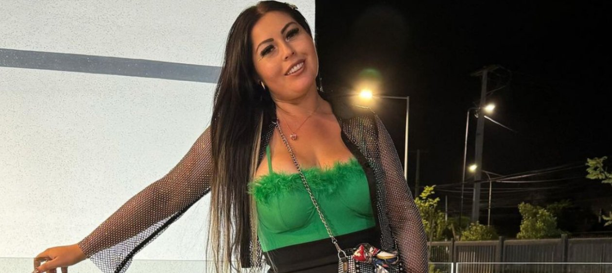 Camila Arismendi mostró cambio tras cirugía estética