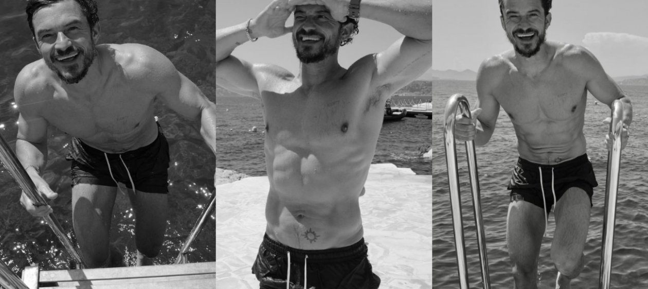 Orlando Bloom se realizó costoso procedimiento para