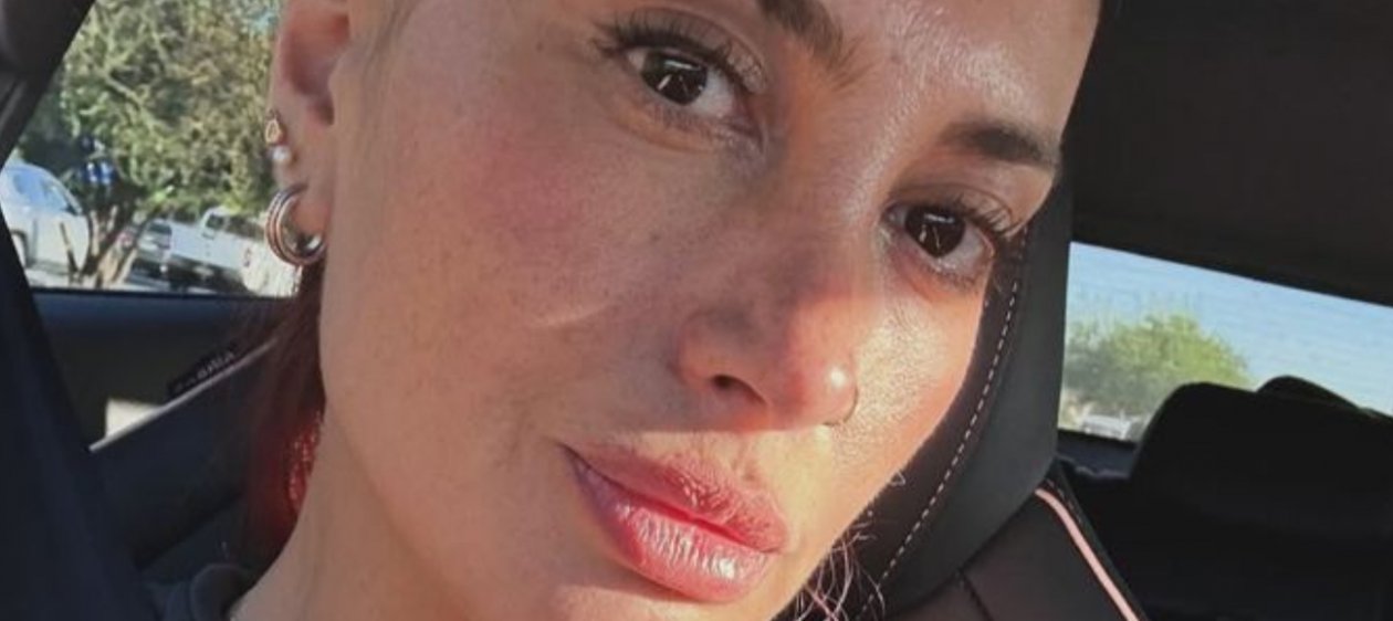 ¡Al natural! Karen Paola se muestra en redes luego de su internación