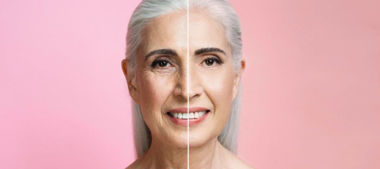 Volumisse: la tecnología que revoluciona la belleza regenerativa sin bisturí ya está en Chile