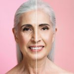 Volumisse: la tecnología que revoluciona la belleza regenerativa sin bisturí ya está en Chile