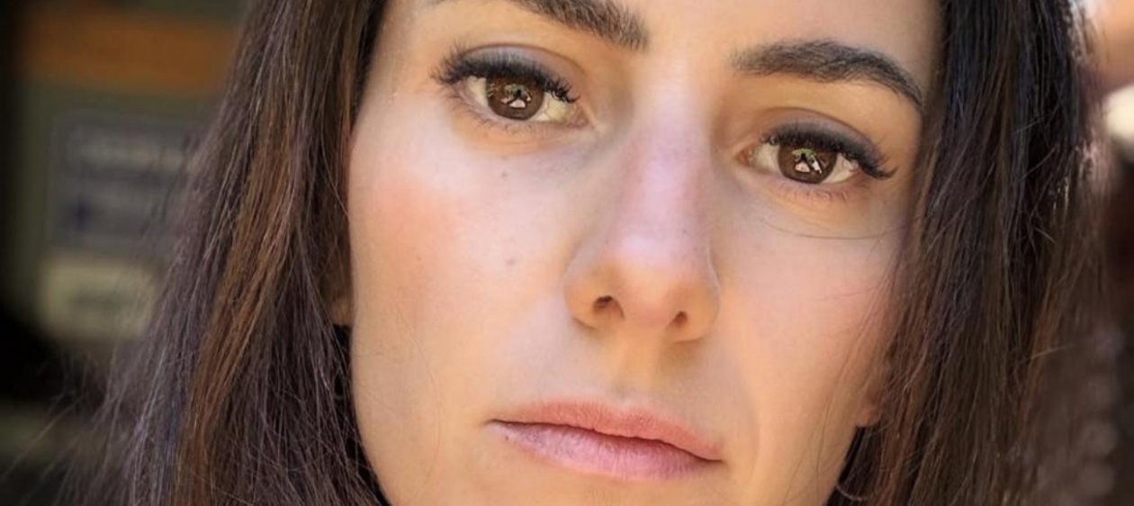 ¡Chao arrugas! Rosario Bravo se sometió a tratamiento estético