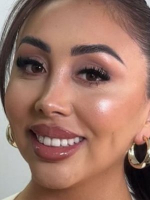 Naya Fácil anuncia cirugía estética motivada por experiencia en Medio Oriente