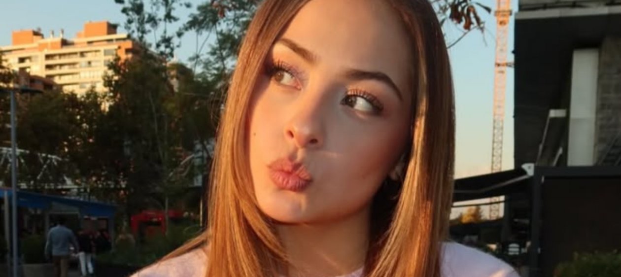 ¡Antes y después! Skarleth Labra mostró el cambio de su rostro tras operación