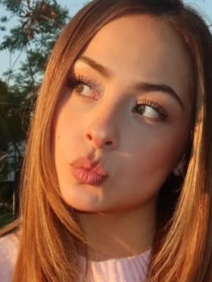 ¡Antes y después! Skarleth Labra mostró el cambio de su rostro tras operación